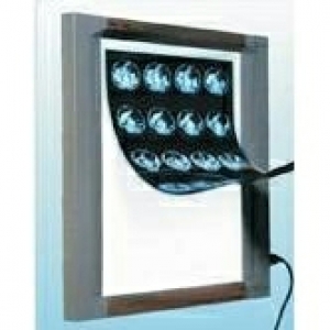 X-RAY VIEWER
